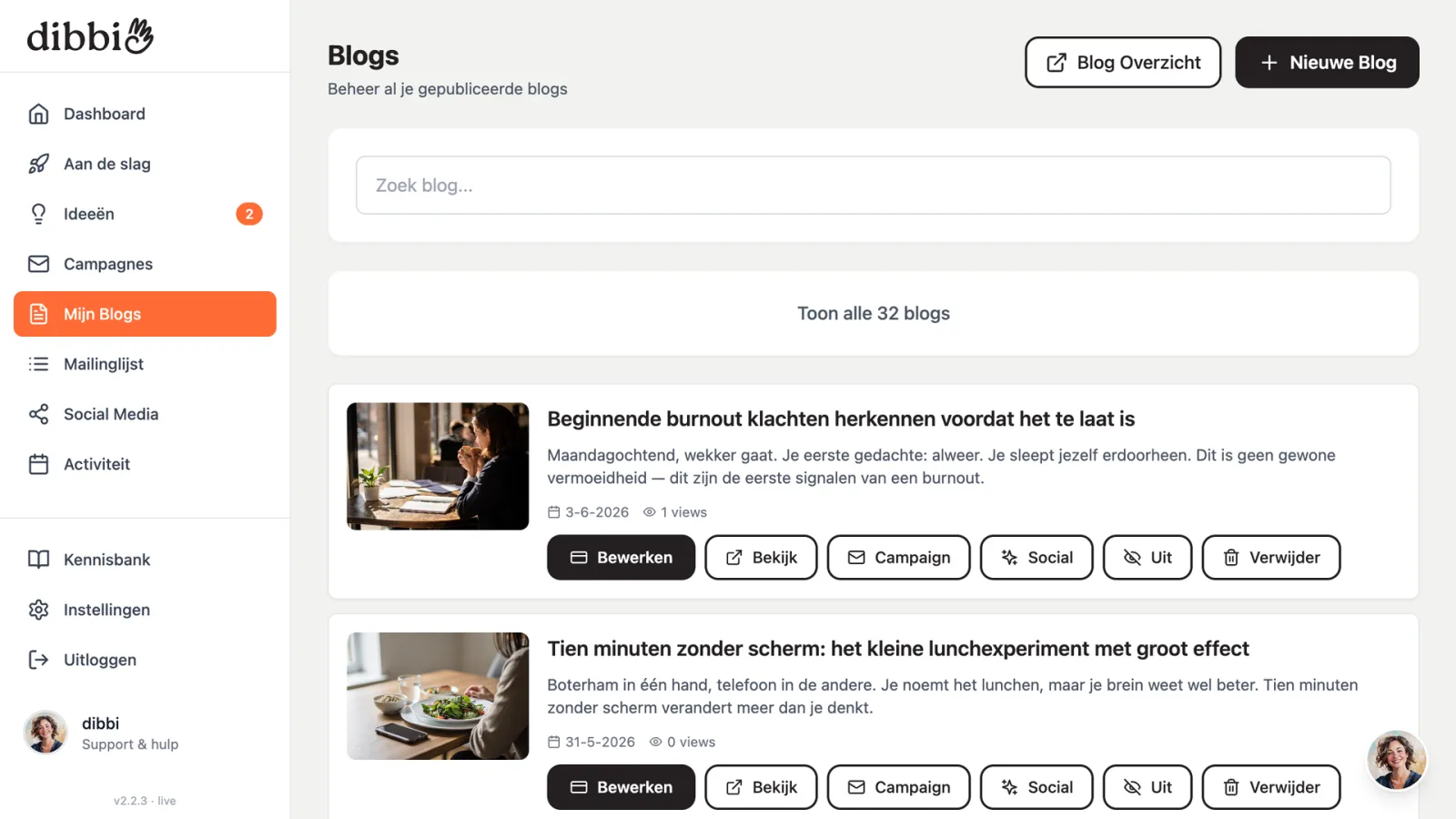 Je blogoverzicht in dibbi met de knop Campagne