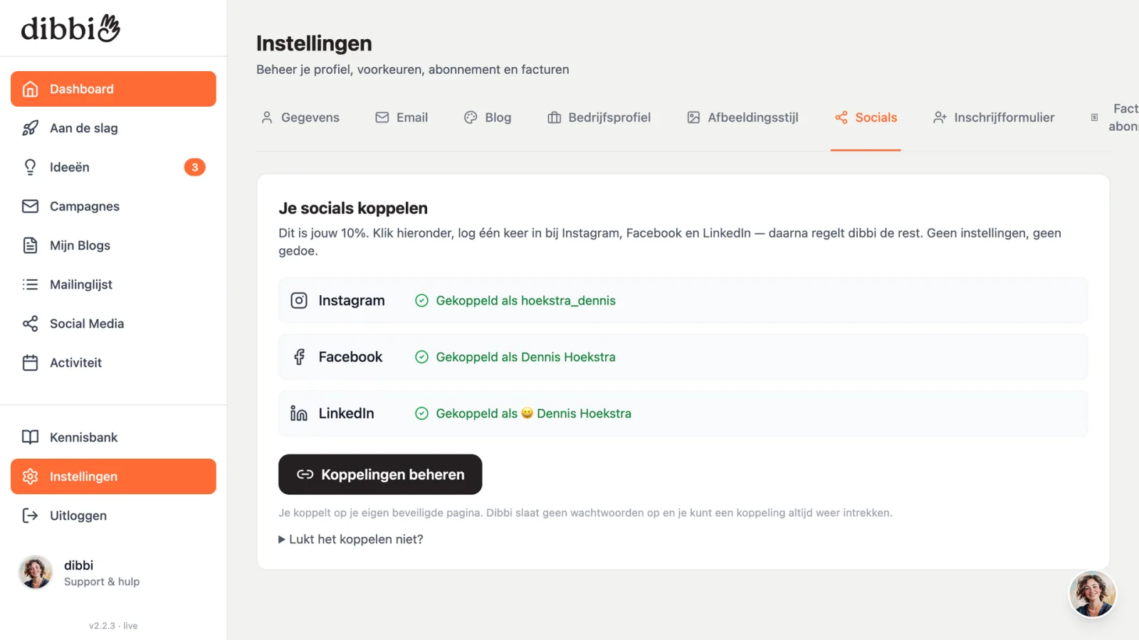 Het Socials-instellingenscherm in dibbi met de knop om je kanalen te koppelen